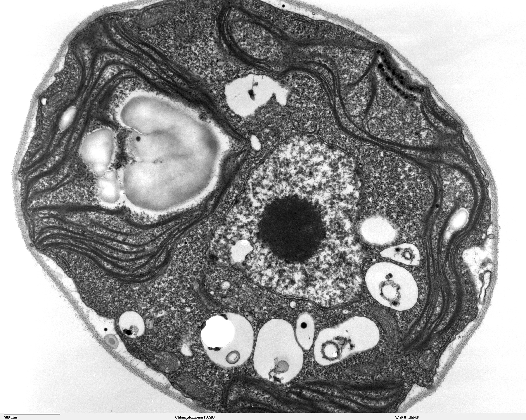Electron microscope image of an algal cell. The image is black and white. The cell is roughly round. Several round structures are visible within the cell, including the nucleus. There are also what appear to be long filaments throughout the cytoplasm.